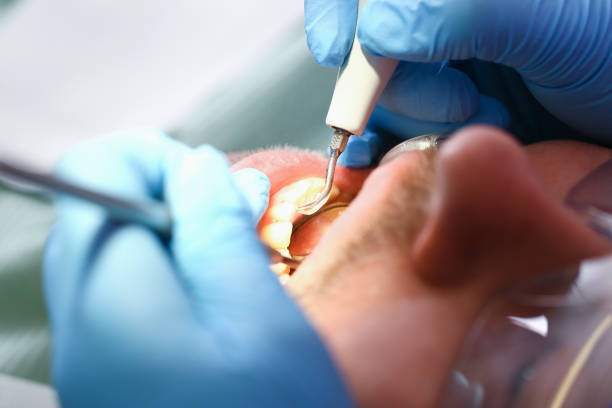 Best Emergency Treatment for Toothache in Oneonta, NY