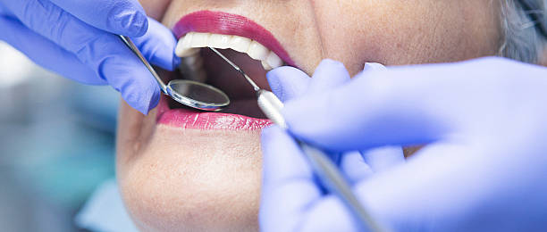 Best Emergency Treatment for Toothache in Oneonta, NY